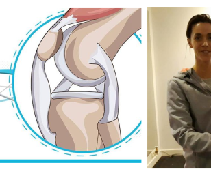 Rehabilitacja po zabiegach artroskopowych kolana – uszkodzenie więzadła krzyżowego przedniego